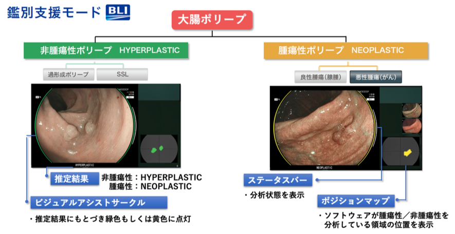 鑑別支援モード