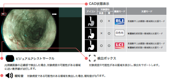 次世代内視鏡システム ビジュアルアシストサークル